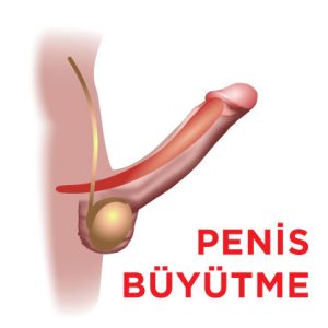 penis büyütme estetiği ameliyatı